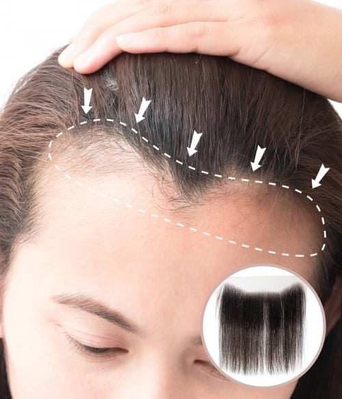 ” X 11” Full Lace Hand-tied Front Hairline Human Hair Patch | 10