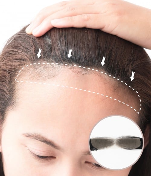 Best Hair Patches For Women