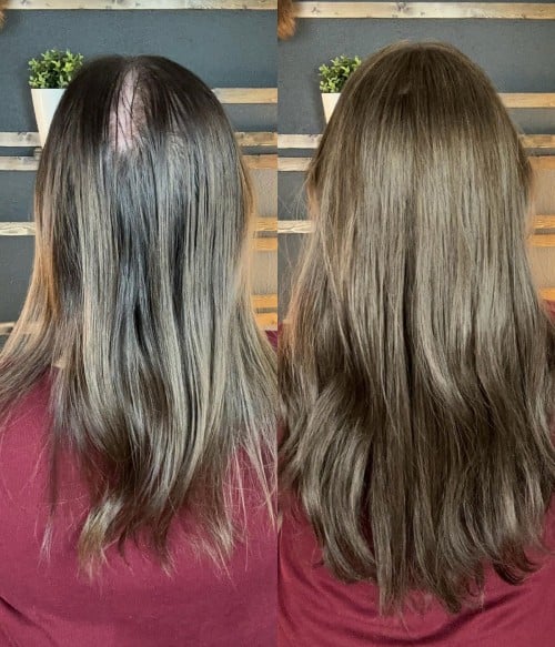 7.5” x 7.5” Upgrade Aura Skin Top Human Hair Topper | With Layers