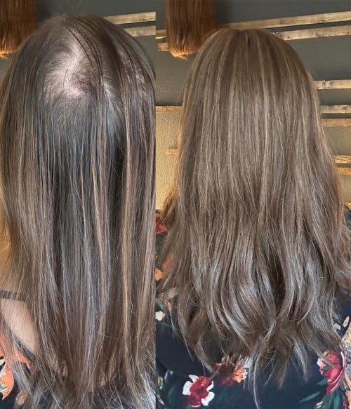 7" x 8" Upgrade Courtney Mono Top Human Hair Topper | With Pre-cut Layers