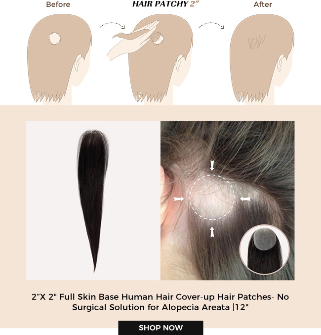 2X2 Full Skin Base Human Hair Cover-up Hair Patches- No Surgical Solution for Alopecia Areata |12