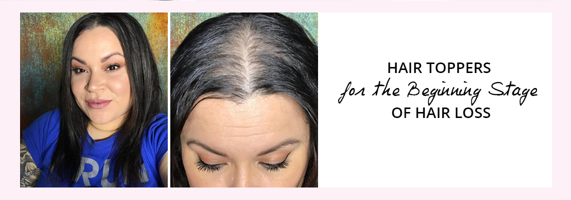 hair toppers for beginning stage hair loss