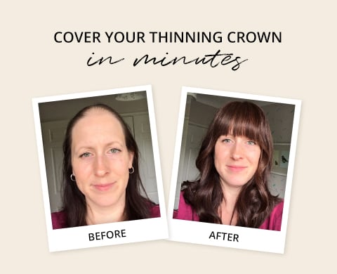 hair toppers for thinning crown