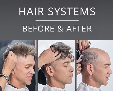 HAIR SYSTEMS BEFORE & AFTER
