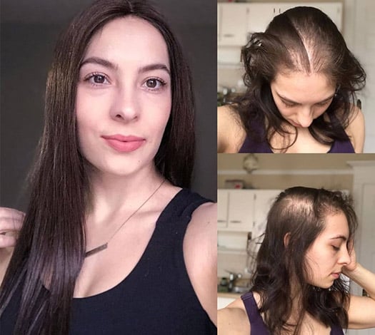 Hair Topper Before and After