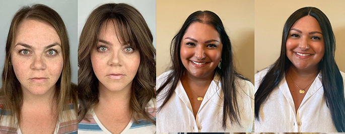 ADD VOLUME ON TOP OF THE HEADWITH HAIR TOPPERS