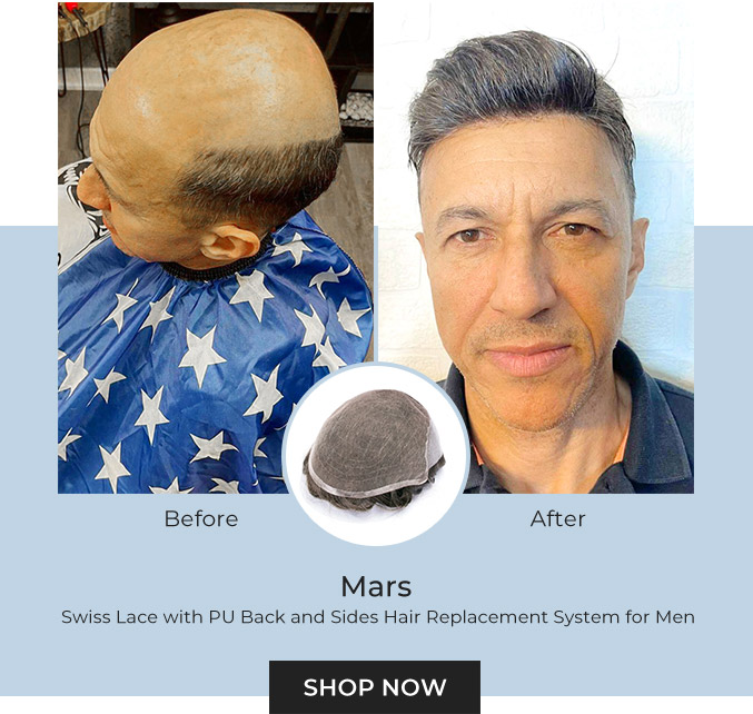 Mars - Swiss Lace With PU Back And Sides Hair Replacement System For Men | Popular Choice