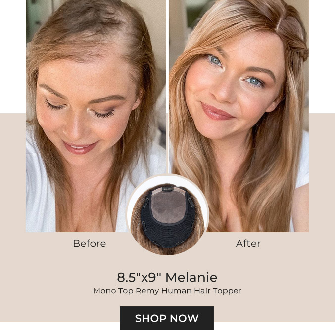 8.5”X9” Melanie | Mono Top Remy Human Hair Topper