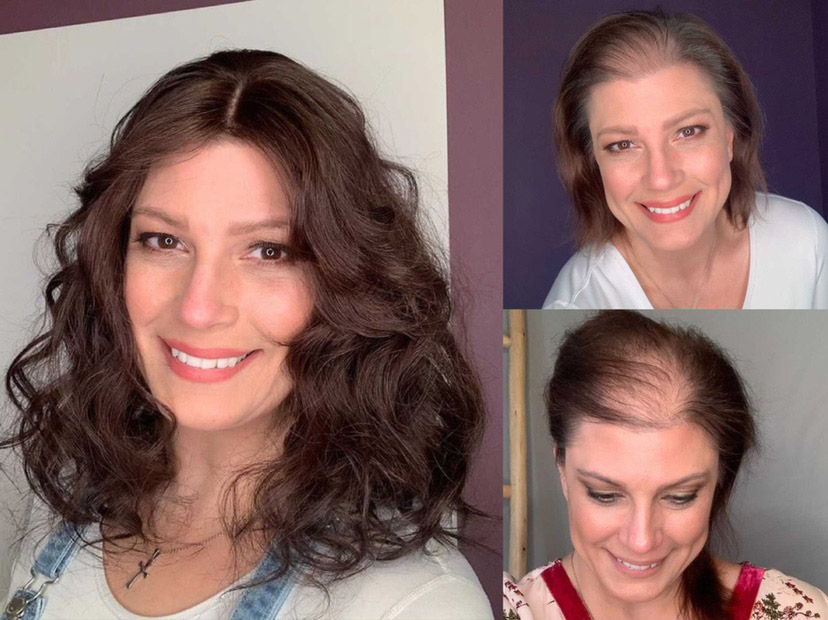 7"x8" Courtney | Mono Part | Middle Part Remy Human Hair Topper