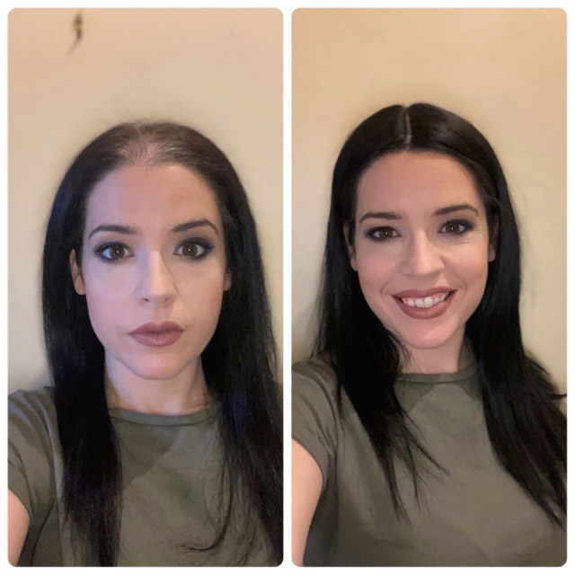 7"x8" Courtney | Mono Part | Middle Part Remy Human Hair Topper