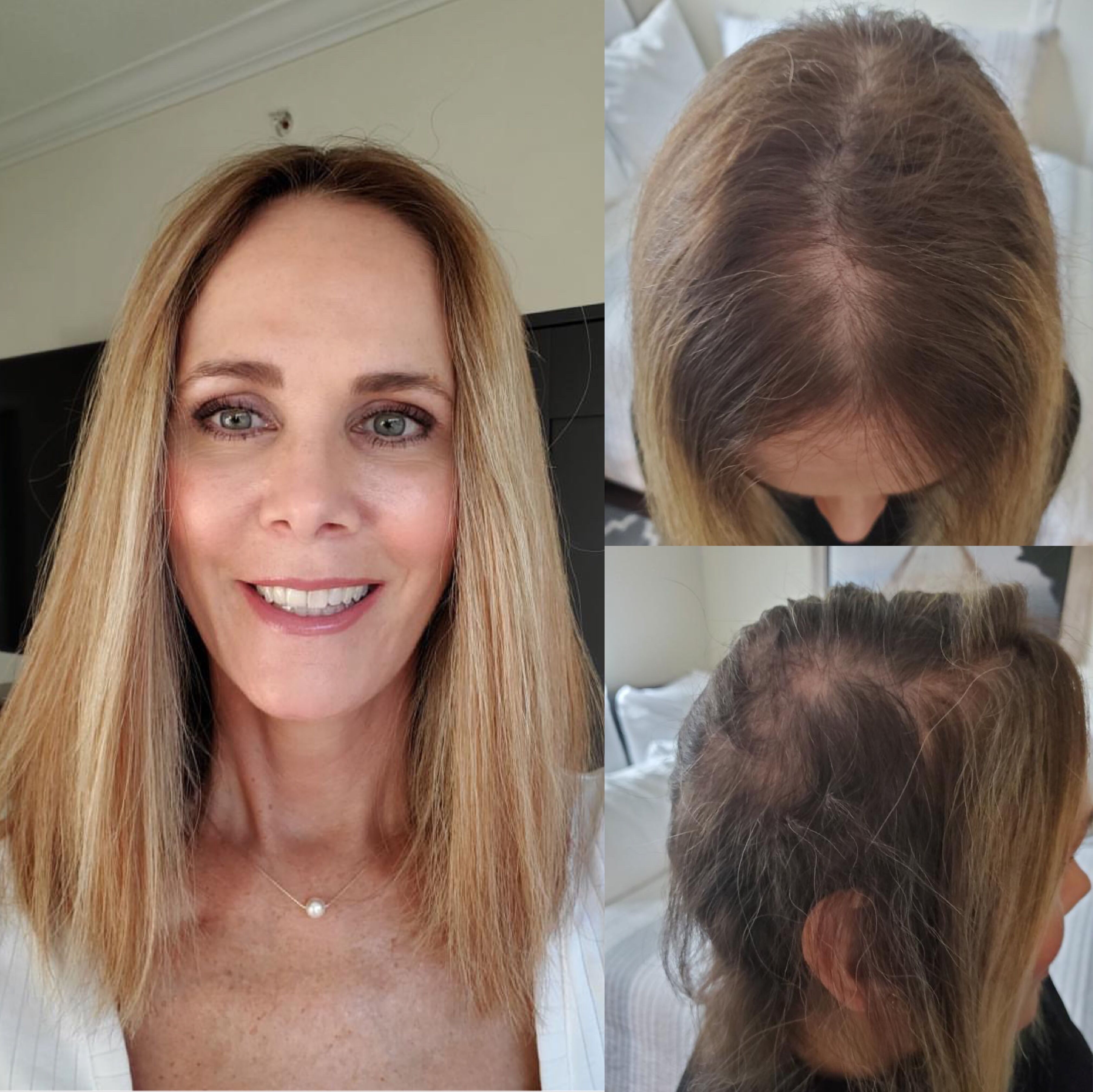 6.5"x6.5" Upgrade Claire Plus | Mono Top Remy Human Hair Topper | Halo-wire | Lace Front