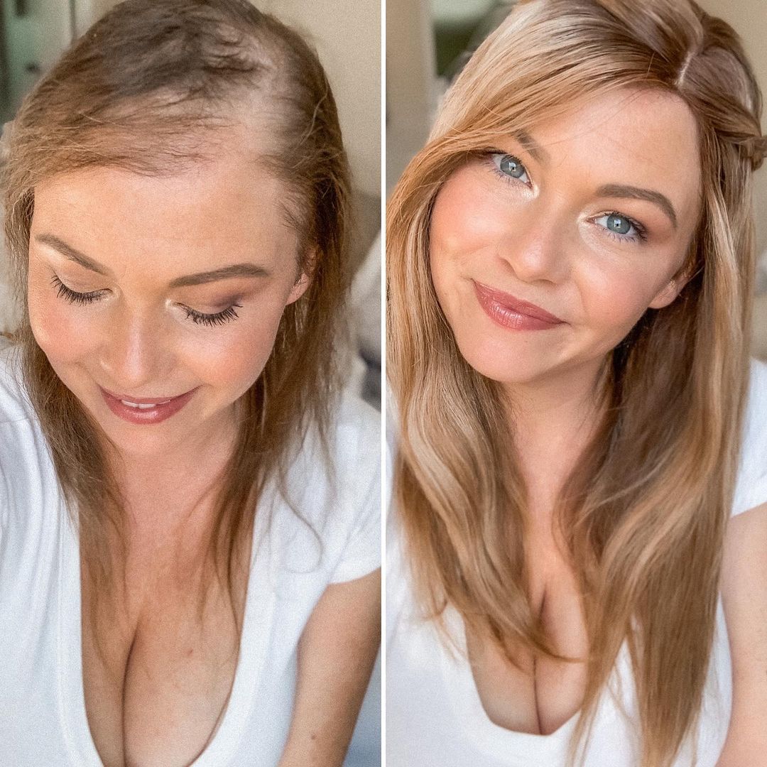 8.5"x9" Melanie | Mono Top Remy Human Hair Topper