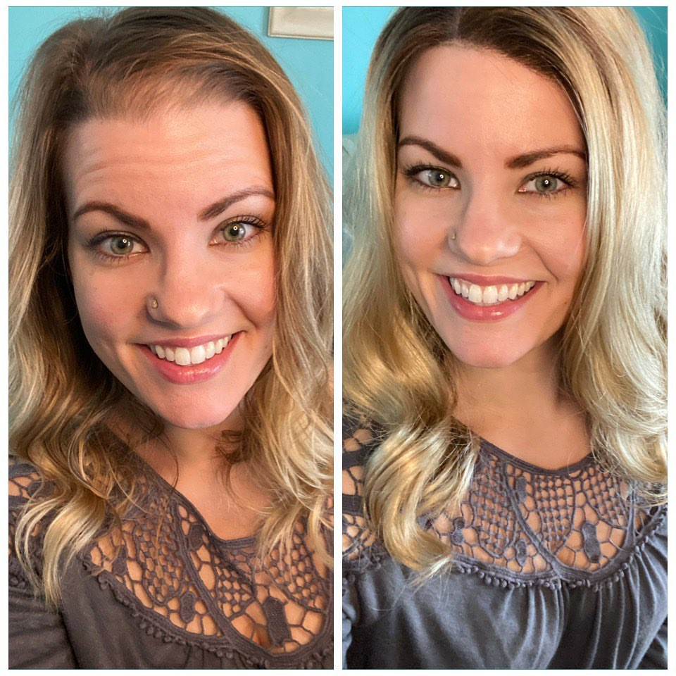 8.5"x9" Hope | Wavy Mono Top Synthetic Hair Topper | Lace Front
